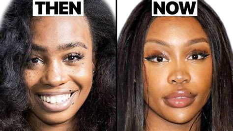 Does SZA Have Plastic Surgery? Exploring the Intersection of Celebrity and Cosmetic Enhancements